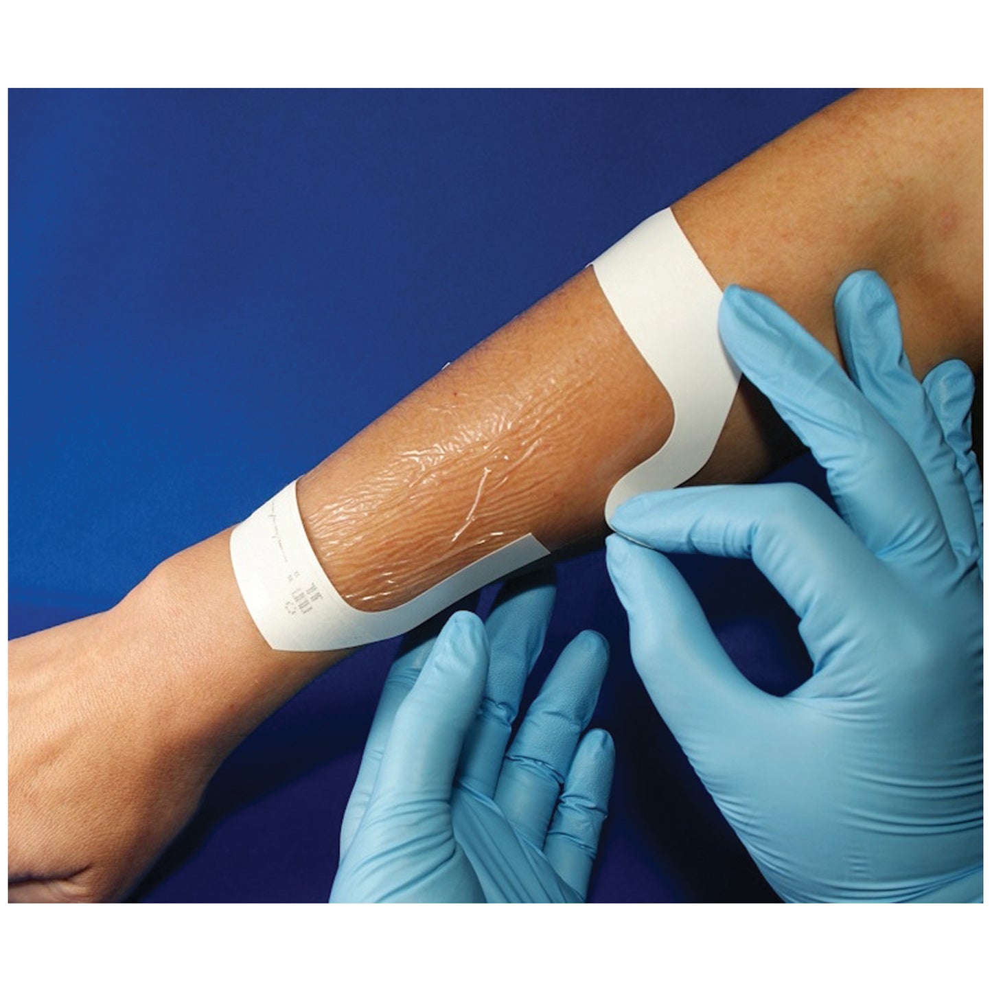AMD MEDICOM TRANSPARENT DRESSING, 40 per pack, 4 packs per case