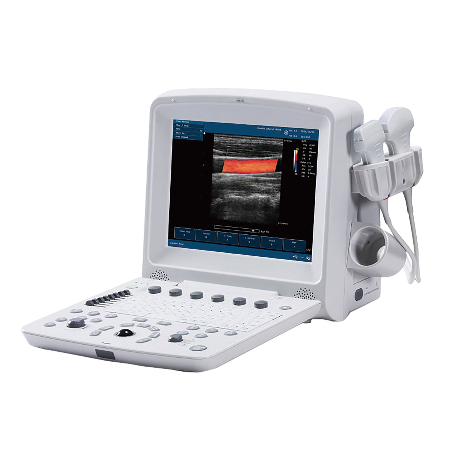 D.R.E. AVANTE DRE ULTRASOUND