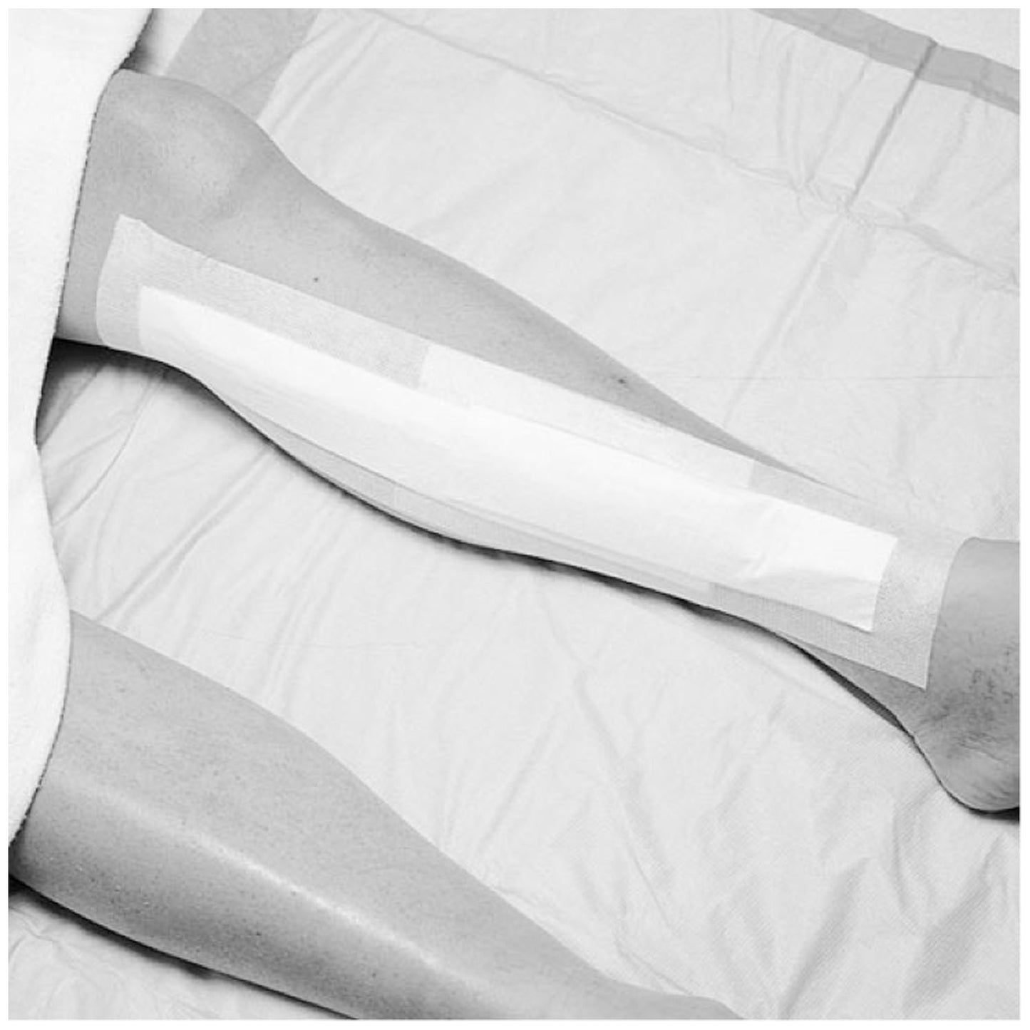 SOLVENTUM MEDIPORE +PAD SOFT CLOTH ADHESIVE WOUND DRESSING, 25 per box, 4 boxes per case