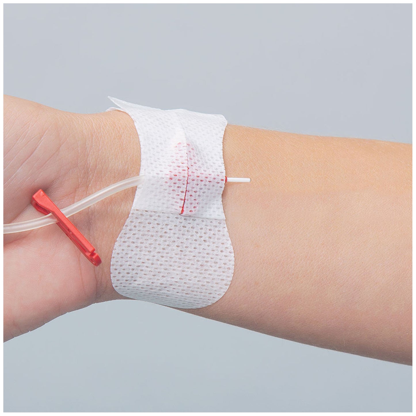 TIDI GRIP-LOK ARTERIAL CATHETER SECUREMENT DEVICE, 100 per box