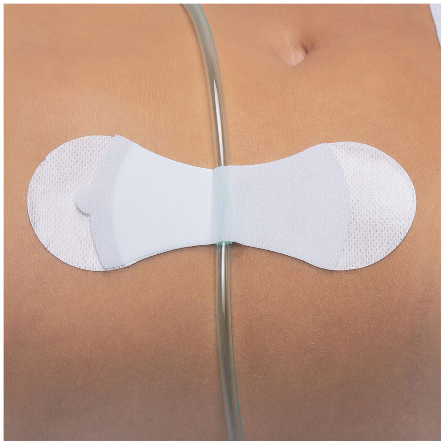 TIDI GRIP-LOK UNIVERSAL SECUREMENT DEVICE, 100 per box