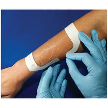 AMD MEDICOM TRANSPARENT DRESSING, 40 per pack, 4 packs per case