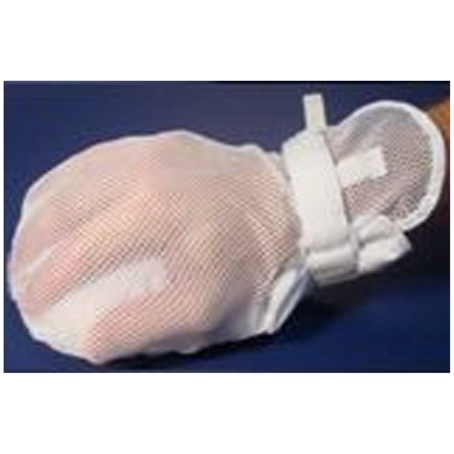 MARKETLAB MEDI-TECH INTERNATIONAL PROTECTIVE MITTS